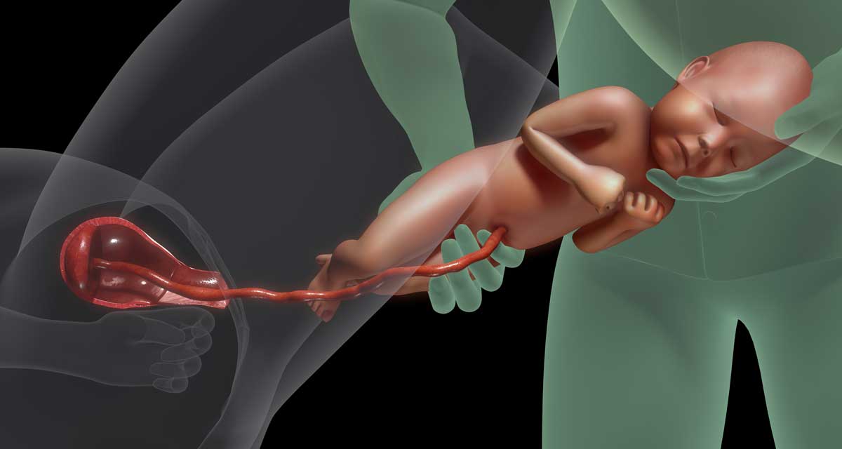 Placenta Aan De Voorkant Of Achterkant Voordelen En Risico S